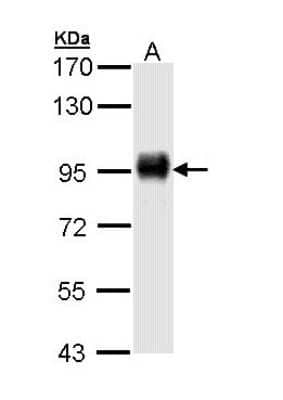 Western Blot: CD44 Antibody [NBP2-15809] - Sample (30 ug of whole cell lysate) A: Hela 7. 5% SDS PAGE gel, diluted at 1:1000.