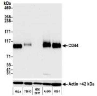 Western Blot: CD44 Antibody [NBP3-14671] - Samples:Whole cell lysate (10 ug) from HeLa, 786-O, HEK293T,A-549, and KG-1 cells prepared using NETN lysis buffer.Antibody: Rabbit anti-CD44 recombinant monoclonalantibody used at 1:1000.Secondary: HRP-conjugated goat anti-rabbit IgG. Chemiluminescence with an exposure timeof 3 seconds. Lower Panel: Rabbit anti-Actin recombinantmonoclonal antibody.