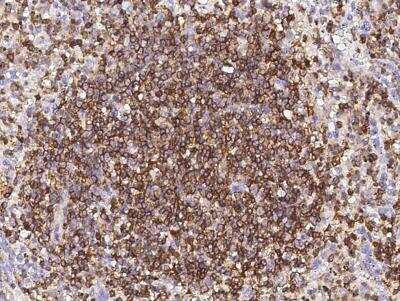 Immunohistochemistry-Paraffin: CD45 Antibody (145) [NBP2-89219] - Staining of human LCA in human spleen with rabbit monoclonal CD45 antibody (145) [NBP2-89219] at 1:200 dilution.