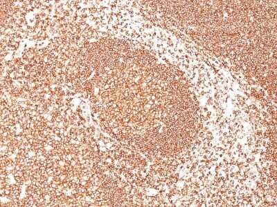 Formalin-fixed, paraffin-embedded human tonsil (10X) stained with CD45 Antibody (2B11 + PD7/26).