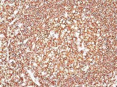 Formalin-fixed, paraffin-embedded human tonsil (20X) stained with CD45 Antibody (2B11 + PD7/26).