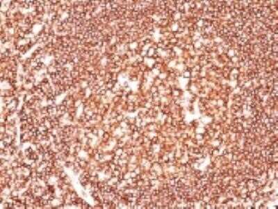 Immunohistochemistry-Paraffin: CD45 Antibody (2B11) - Azide and BSA Free [NBP2-34527] - Formalin-fixed, paraffin-embedded human tonsil stained with CD45 antibody (2B11).
