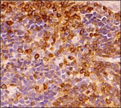 Immunohistochemistry-Paraffin: CD45 Antibody (30-F11) - Azide and BSA Free [NBP2-80652] - Analysis of a FFPE section of mouse spleen using rat monoclonal CD45 antibody (30-F11) at 1:50 dilution. The antibody generated an expected membrane staining in the red and white pulp spleenocytes of the tested spleen section. Image from the standard format of this antibody.