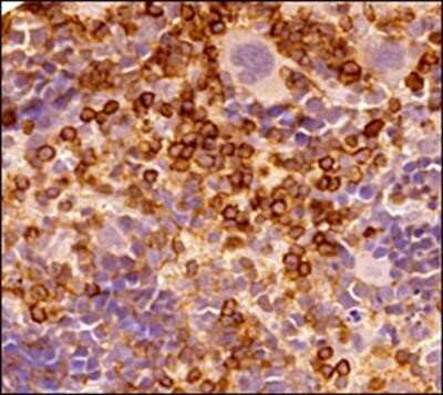 Immunohistochemistry-Paraffin: CD45 Antibody (30-F11) - Azide and BSA Free [NBP2-80652] - Analysis of FFPE section of mouse spleen using rat monoclonal CD45 antibody (30-F11) at 1:50 dilution. The antibody generated an expected membrane staining in the red and white pulp spleenocytes of the tested spleen section. Image from the standard format of this antibody.