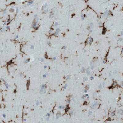 Immunohistochemistry-Paraffin: CD45 Antibody (CL0159) [NBP2-52868] - Staining of human cortex using CD45 antibody (CL0159) [NBP2-52868] shows strong immunoreactivity in microglia.