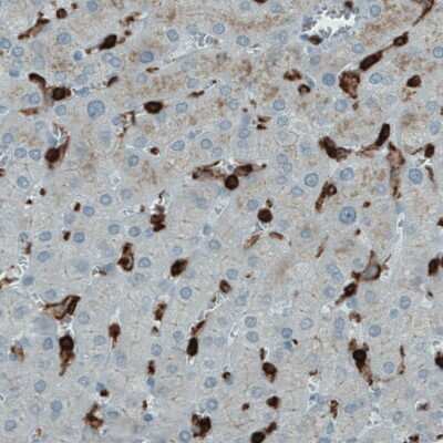 Immunohistochemistry-Paraffin: CD45 Antibody (CL0159) [NBP2-52868] - Staining of human liver with CD45 antibody (CL0159) [NBP2-52868] shows strong positivity in Kupffer cells.