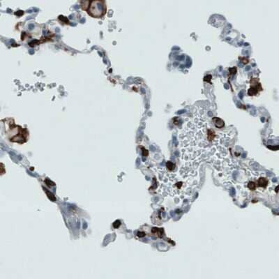 Immunohistochemistry-Paraffin: CD45 Antibody (CL0159) [NBP2-52868] - Staining of human lung with CD45 antibody (CL0159) [NBP2-52868] shows strong membranous positivity in macrophages.