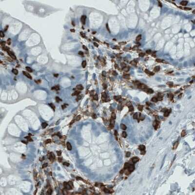 Immunohistochemistry-Paraffin: CD45 Antibody (CL0159) [NBP2-52868] - Staining of human small intestine with CD45 antibody (CL0159) [NBP2-52868] shows strong immunoreactivity in lymphoid cells.