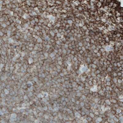 Immunohistochemistry-Paraffin: CD45 Antibody (CL0159) [NBP2-52868] - Staining of human tonsil with CD45 antibody (CL0159) [NBP2-52868] shows strong membranous immunoreactivity in lymphoid cells.