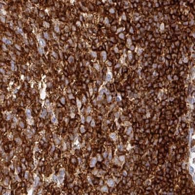 Immunohistochemistry-Paraffin: CD45 Antibody (CL0160) [NBP2-14783] - Staining of human tonsil using CD45 antibody (CL0160) [NBP2-14783] shows strong positivity in a majority of lymphoid cells