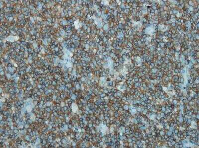 Immunohistochemistry-Paraffin: CD45 Antibody (E19-G) [NBP1-30145] - Expression in lymphoid cells of the lymph node using formalin fixed, paraffin embedded human tissues. Staining with CD45 antibody (E19-G) [NBP1-30145].