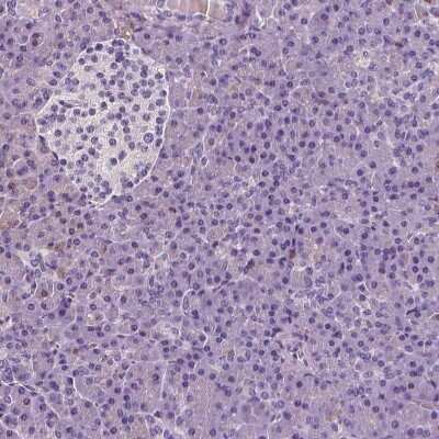 <b>Orthogonal Strategies Validation. </b>Immunohistochemistry-Paraffin: CD45 Antibody [NBP1-88103] - Staining of human pancreas with CD45 antibody [NBP1-88103] shows low expression as expected.