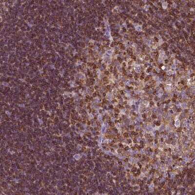 Immunohistochemistry-Paraffin: CD45 Antibody [NBP1-88103] - Staining of human tonsil with CD45 antibody [NBP1-88103] shows high expression.