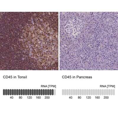 Immunohistochemistry-Paraffin: CD45 Antibody [NBP1-88103] - Staining in human tonsil and pancreas tissues using CD45 antibody [NBP1-88103]. Corresponding CD45 RNA-seq data are presented for the same tissues.
