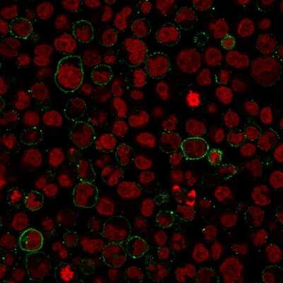 Immunocytochemistry/Immunofluorescence: CD45 Antibody (PTPRC/1975R) [NBP3-07167] - Paraformaldehyde-fixed Raji cells stained with CD45 Rabbit Recombinant Monoclonal Antibody (PTPRC/1975R) followed by Goat anti-rabbit IgG-CF488 (Green). Counterstain is Phalloidin (red).