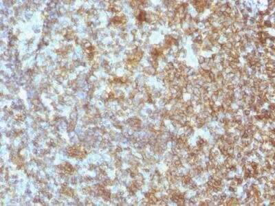 Immunohistochemistry-Paraffin: CD45 Antibody (SPM496) - IHC-Prediluted [NBP2-48439] - Formalin-fixed, paraffin-embedded human Tonsil stained with CD45 Antibody (SPM496).