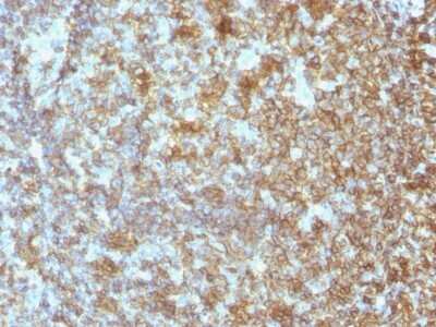 Immunohistochemistry-Paraffin: CD45 Antibody (SPM496) [NBP2-44841] - Human Tonsil stained with CD45 antibody (SPM496) [NBP2-44841].