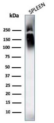 Western Blot: CD45 Antibody (SPM569 + SPM570) - Azide and BSA Free [NBP2-34430] - Western Blot Analysis of human spleen tissue lysates using CD45 Antibody (SPM569 + SPM570) [NBP2-34430]. Observed molecular weight ~150 kDa.