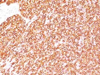 Immunohistochemistry-Paraffin: CD45 Antibody (SPM570) - IHC-Prediluted [NBP2-44854] - Formalin-fixed, paraffin-embedded human Tonsil stained with CD45 Antibody (SPM570).