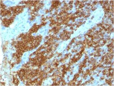 Immunohistochemistry-Paraffin: CD45RA Antibody (111-1C5) - IHC-Prediluted [NBP2-48452] - Formalin-fixed, paraffin-embedded human tonsil stained with CD45RA Mouse Monoclonal Antibody (111-1C5)