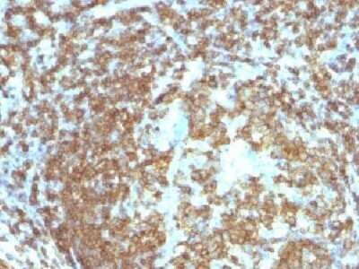 Immunohistochemistry-Paraffin: CD45RA Antibody (158-4D3) - IHC-Prediluted [NBP2-44851] - Formalin-fixed, paraffin-embedded human Tonsil stained with CD45RA Monoclonal Antibody (158-4D3).
