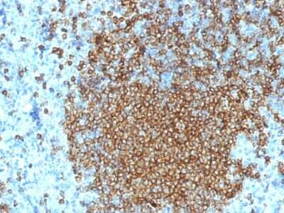 Immunohistochemistry-Paraffin: CD45RA Antibody (K4B5) - Azide and BSA Free [NBP3-08901] - Formalin-fixed, paraffin-embedded human Spleen stained with CD45RA Mouse Monoclonal Antibody (K4B5).