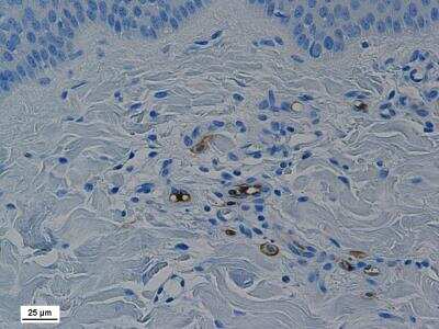 Immunohistochemistry-Paraffin: CD45RA Antibody (MIL13) [NB100-64997] - Porcine skin section was stained with anti-CD45RA antibody. Image from verified customer review. 