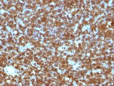 Immunohistochemistry-Paraffin: CD45RA Antibody (PTPRC/1131) - Azide and BSA Free [NBP2-54336] - Formalin-fixed paraffin-embedded human Tonsil stained with CD45RA Monoclonal Antibody (PTPRC/1131).