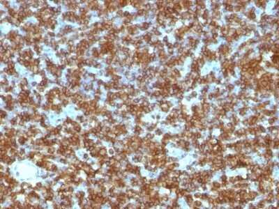 Immunohistochemistry-Paraffin: CD45RA Antibody (PTPRC/1131) - IHC-Prediluted [NBP2-48450] - Immunohistochemistry-Paraffin: CD45RA Antibody (PTPRC/1131) [NBP2-44845] - Human Tonsil stained with CD45RA Monoclonal Antibody (PTPRC/1131).