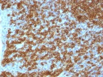 Immunohistochemistry-Paraffin: CD45RA Antibody (PTPRC/1148) - Azide and BSA Free [NBP2-54335] - Formalin-fixed, paraffin-embedded human Tonsil stained with CD45RA Monoclonal Antibody (PTPRC/1148).