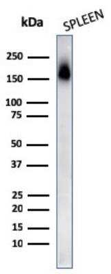 Western Blot: CD45RA Antibody (PTPRC/818) - Azide and BSA Free [NBP2-47957] - Human Spleen tissue lysates using CD45RA Mouse Monoclonal Antibody (PTPRC/818).