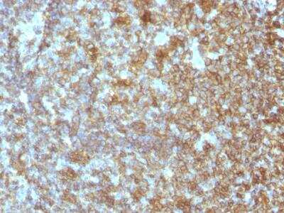 Immunohistochemistry-Paraffin: CD45RA Antibody (SPM504) - IHC-Prediluted [NBP2-48453] - Formalin-fixed, paraffin-embedded human Tonsil stained with CD45RA Monoclonal Antibody (SPM504).