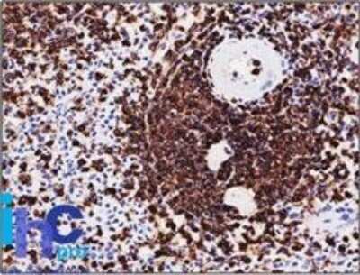 Immunohistochemistry-Paraffin: CD45RA Antibody (SPM568) - Azide and BSA Free [NBP2-34802] - Formalin-paraffin human spleen stained with CD45RA MAb (SPM568).