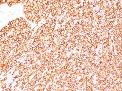 Immunohistochemistry-Paraffin: CD45RB Antibody (BRA-11 (same as BRA-11G)) - Azide and BSA Free [NBP2-34564] - Formalin-fixed, paraffin-embedded human tonsil stained with CD45RB Ab (BRA-11).