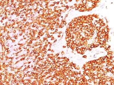 Immunohistochemistry-Paraffin: CD45RB Antibody (DF-B1) - IHC-Prediluted [NBP2-48458] - Formalin-fixed, paraffin-embedded human Tonsil stained with CD45RB Monoclonal Antibody (DF-B1).