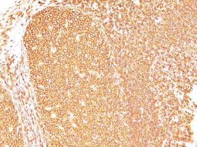 Immunohistochemistry-Paraffin: CD45RB Antibody (PD7/26) - Azide and BSA Free [NBP2-34708] - Formalin-fixed, paraffin-embedded human tonsil (10X) stained with CD45RB MAb (PD7/26).