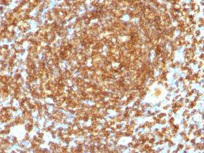 Immunohistochemistry-Paraffin: CD45RB Antibody (PTPRC/1132) - IHC-Prediluted [NBP2-48459] - Formalin-fixed, paraffin-embedded human Tonsil stained with CD45RB Monoclonal Antibody (PTPRC/1132).