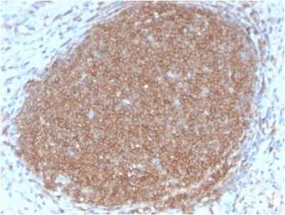 Immunohistochemistry-Paraffin: CD45RB Antibody (PTPRC/2877R) - Azide and BSA Free [NBP3-08924] - Formalin-fixed, paraffin-embedded human Lymph Node stained with CD45RB Rabbit Recombinant Monoclonal Antibody (PTPRC/2877R).