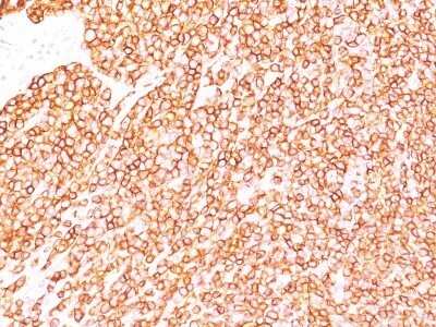Immunohistochemistry-Paraffin: CD45RB Antibody (SPM569) - IHC-Prediluted [NBP2-44856] - Formalin-fixed, paraffin-embedded human tonsil (20X) stained with CD45RB MAb (SPM569).