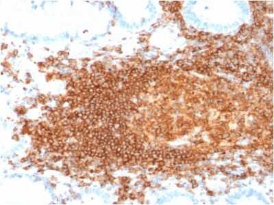 Immunohistochemistry-Paraffin: CD45RB Antibody (rPTPRC/1132) - Azide and BSA Free [NBP3-08909] - Formalin-fixed, paraffin-embedded human Lymph Node stained with CD45RB Recombinant Mouse Monoclonal Antibody (rPTPRC/1132).