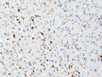 Immunohistochemistry-Paraffin: CD45RC Antibody (RM291) [NBP2-61512] - Immunohistochemical staining of formalin fixed and paraffin embedded human liver tissue sections using NBP2-61512 at a 1:400 dilution.