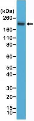 Western Blot: CD45RC Antibody (RM291) [NBP2-61512] - Western Blot of Jurkat cell lysates using NBP2-61512 at a 1:2000 dilution