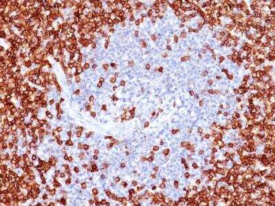 Immunohistochemistry-Paraffin: CD45RO Antibody (T200/797) - IHC-Prediluted [NBP2-48465] - Formalin-fixed, paraffin-embedded human Tonsil stained with CD45RO Mouse Monoclonal Antibody (T200/797).
