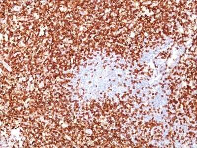 Immunohistochemistry-Paraffin: CD45RO Antibody (UCHL-1 + T200/797) [NBP2-44849] - Human Tonsil stained with CD45RO Monoclonal Antibody (UCHL-1 + T200/797).