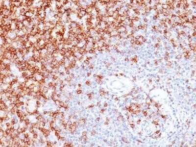 Immunohistochemistry-Paraffin: CD45RO Antibody (UCHL-1) - Azide and BSA Free [NBP2-33104] - Staining of human tonsil