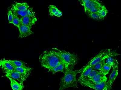 Immunocytochemistry/Immunofluorescence: CD46 Antibody (001) [NBP2-90080] - Staining of CD46 in HepG2 cells. Cells were fixed with 4% PFA, permeabilzed with 0.3% Triton X-100 in PBS, blocked with 10% serum, and incubated with rabbit anti-human CD46 monoclonal antibody (1:60) at 4? overnight. Then cells were stained with the Alexa Fluor® 488-conjugated Goat Anti-rabbit IgG secondary antibody (green) and counterstained with DAPI (blue).