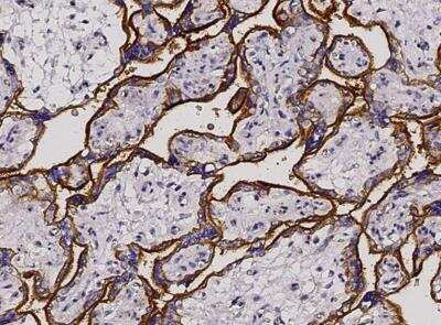 Immunohistochemistry-Paraffin: CD46 Antibody (001) [NBP2-90080] - Staining of human CD46 in human placenta with rabbit monoclonal antibody (1:200). Positive staining was localized to membrane of trophoblast.
