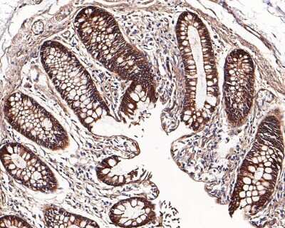 Immunohistochemistry-Paraffin: CD46 Antibody (JB25-49) [NBP2-75436] - Analysis of paraffin-embedded human colon tissue with Rabbit anti-CD46 antibody washed with ddH2O and PBS, and then probed with the primary antibody  at 1/800 dilution for 1 hour at room temperature. The detection was performed using an HRP conjugated compact polymer system. DAB was used as the chromogen. Tissues were counterstained with hematoxylin and mounted with DPX.