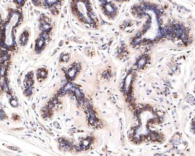 Immunohistochemistry-Paraffin: CD46 Antibody (JB25-49) [NBP2-75436] - Analysis of paraffin-embedded human breast tissue with Rabbit anti-CD46 antibody washed with ddH2O and PBS, and then probed with the primary antibody at 1/400 dilution for 1 hour at room temperature. The detection was performed using an HRP conjugated compact polymer system. DAB was used as the chromogen. Tissues were counterstained with hematoxylin and mounted with DPX.