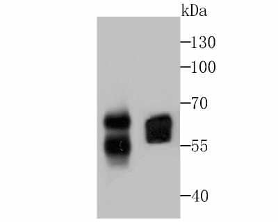 Western Blot: CD46 Antibody (JB25-49) [NBP2-75436] - Analysis of CD46 on Siha and PC-3M cell lysates using anti-CD46 antibody at 1/1,000 dilution.
